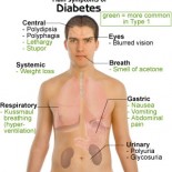 diabet simptome diabet simptome