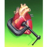 hipertensiune arteriala