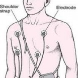 holter la pacient