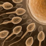 ovul spermatozoizi infertilitate ovul spermatozoizi infertilitate