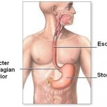 sfincter esofagian inferior - reflux - pirozis sfincter esofagian inferior - reflux - pirozis