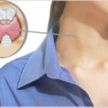 thyroid1 thyroid1