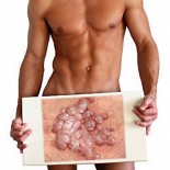 hpv la barbati si aspect condiloame