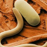 trichinella in muschi