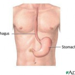 stricturi esofagiene esofag stricturi esofagiene esofag