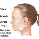 mononucleoza infectioasa simptome mononucleoza infectioasa simptome