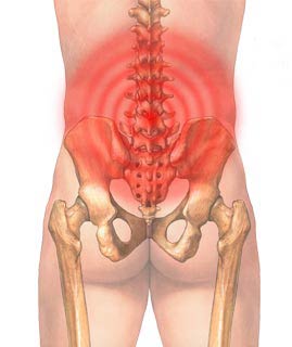 Artrita dureri de spate