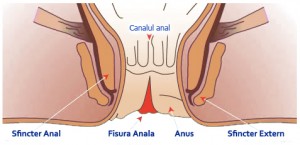 fisura anala